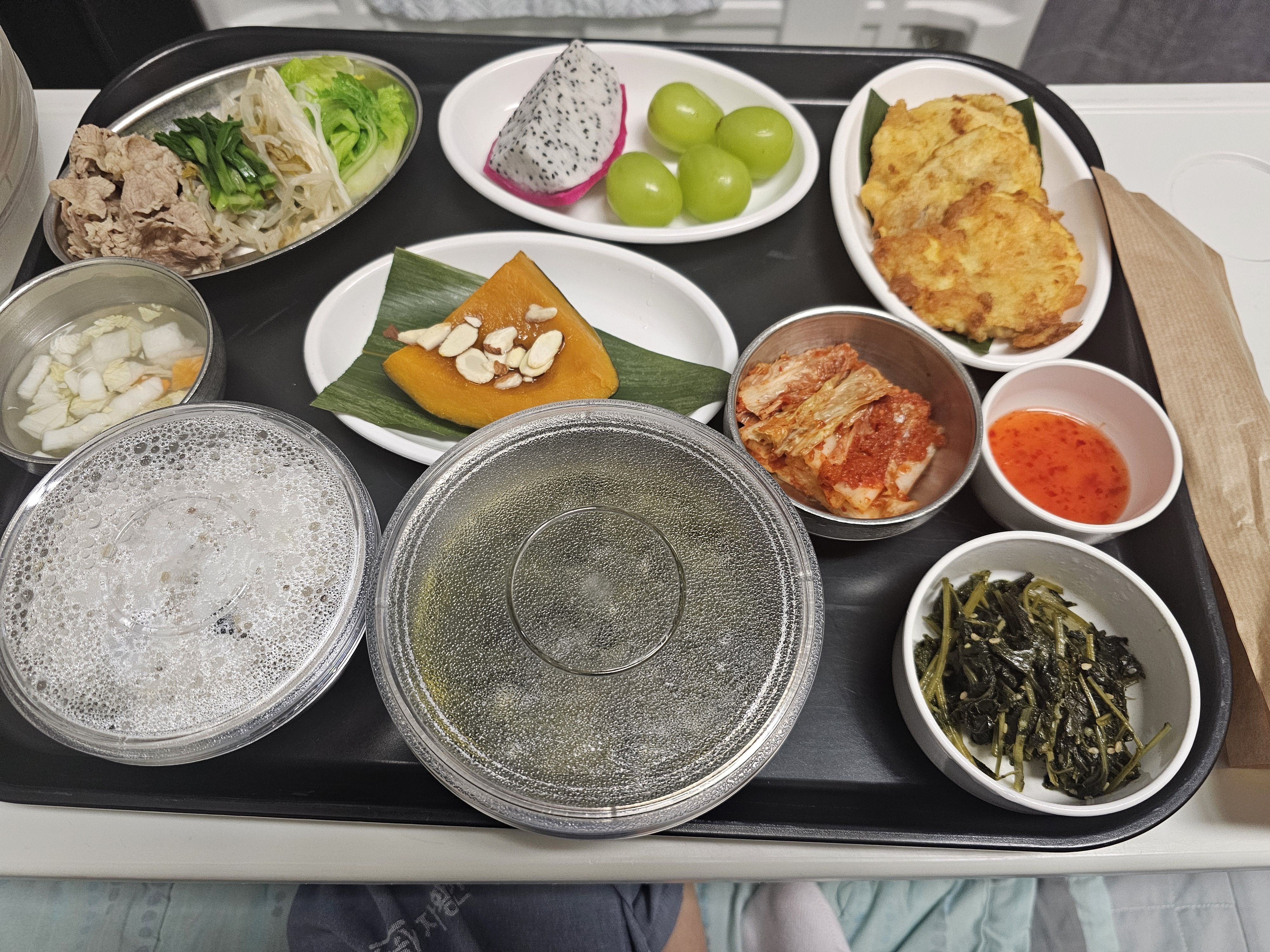 입원후기 이미지 1